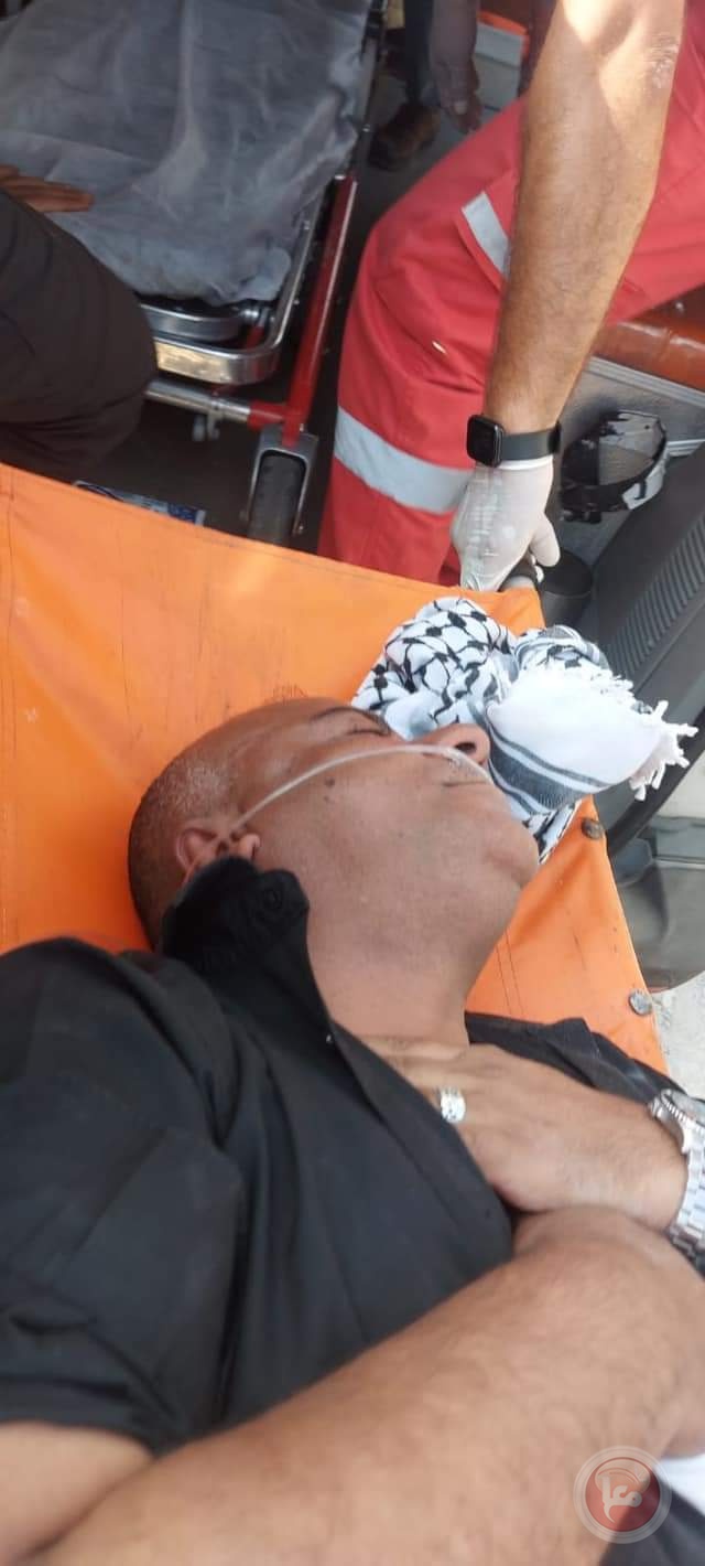 إصابة الوزير مؤيد شعبان جراء اعتداء الاحتلال (فيديو)