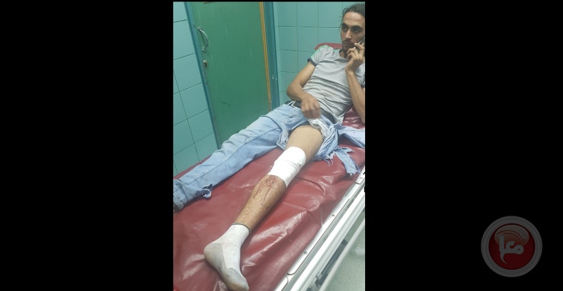 A worker was wounded by Israeli bullets, west of Jenin