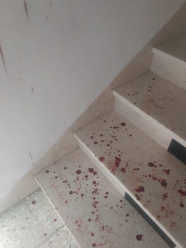 Two injured in settler attack and two young men arrested south of Nablus