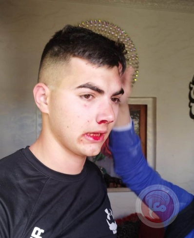 The occupation assaults the Safadi family and injures their son